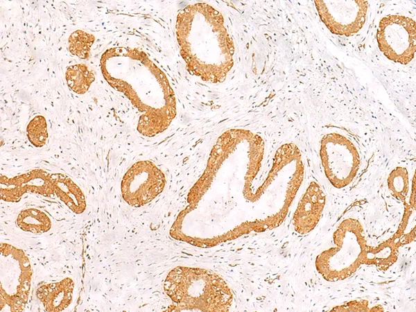 PFDN2 Rabbit Polyclonal Antibody - image 1