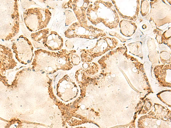 JPT1 Rabbit Polyclonal Antibody - image 1