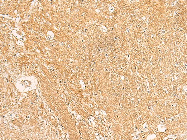 ERp19 (TXNDC12) Rabbit Polyclonal Antibody - image 1