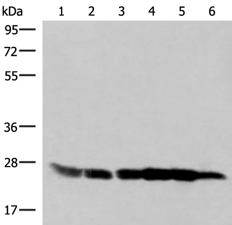 Glutathione S Transferase kappa 1 (GSTK1) Rabbit Polyclonal Antibody - image 1