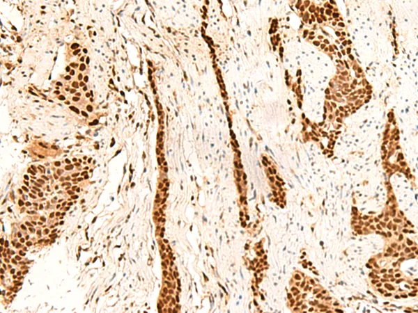 METTL1 Rabbit Polyclonal Antibody - image 1