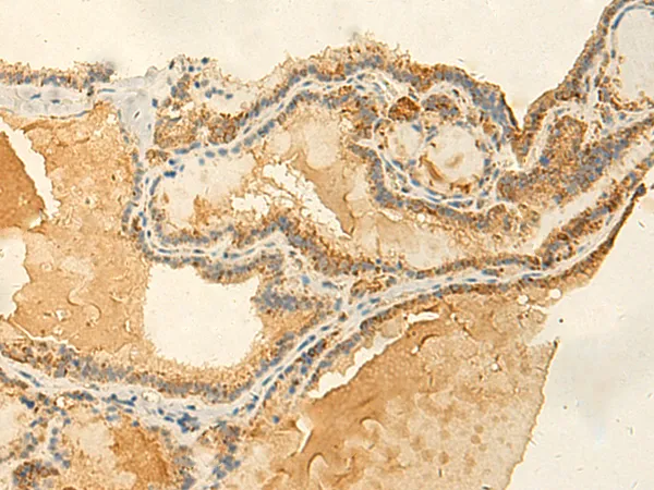 RNF148 Rabbit Polyclonal Antibody - image 1