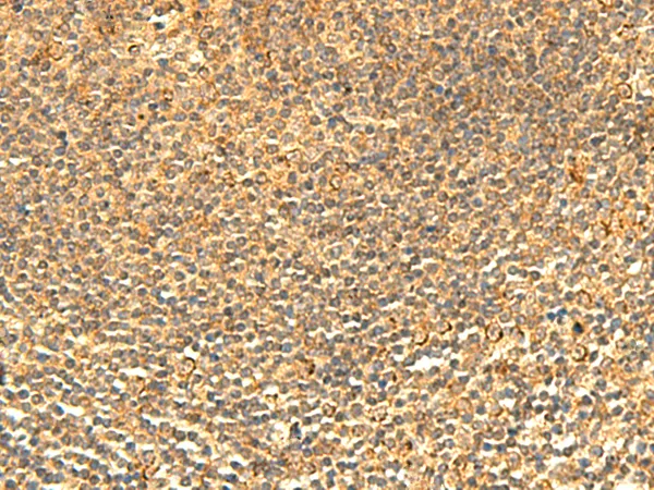 ABHD10 Rabbit Polyclonal Antibody - image 1