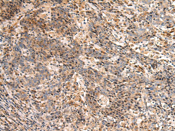 EIF2B2 Rabbit Polyclonal Antibody - image 1
