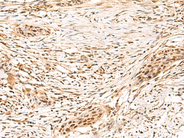 SETMAR Rabbit Polyclonal Antibody - image 1