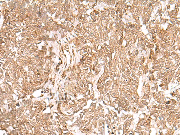 GMPPB Rabbit Polyclonal Antibody - image 1