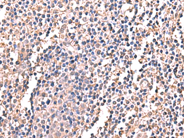 LDHAL6B Rabbit Polyclonal Antibody - image 1