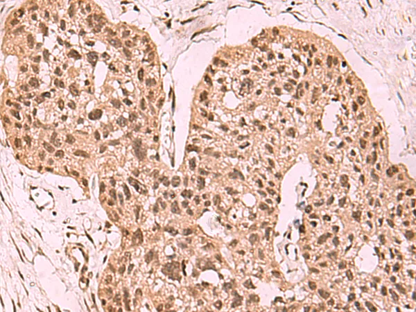 SETDB1 Rabbit Polyclonal Antibody - image 1