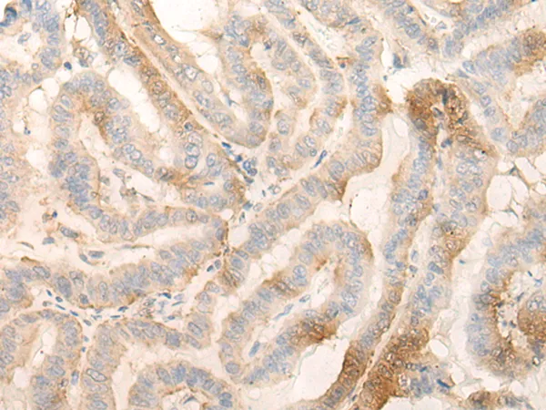 MPPED2 Rabbit Polyclonal Antibody - image 1