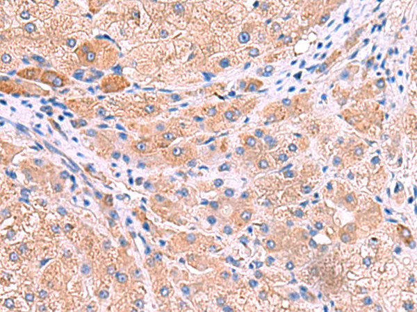 MPP1 Rabbit Polyclonal Antibody - image 1
