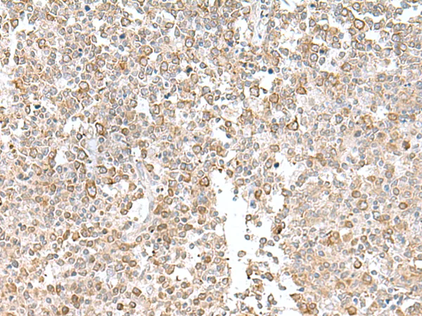 EIF1AY Rabbit Polyclonal Antibody - image 1