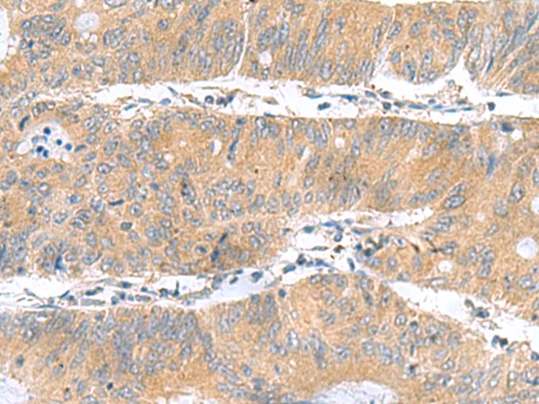 DNAL1 Rabbit Polyclonal Antibody - image 1