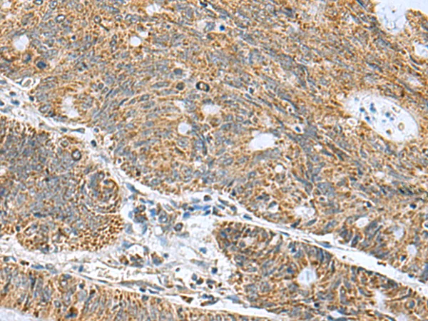 MRPL40 Rabbit Polyclonal Antibody - image 1