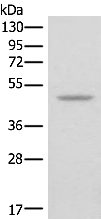MAGEA11 Rabbit Polyclonal Antibody - image 1