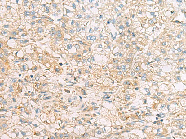 EIF4EL3 (EIF4E2) Rabbit Polyclonal Antibody - image 1