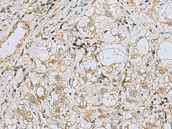 RAB3IP Rabbit Polyclonal Antibody - image 1