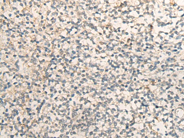 EIF2S2 Rabbit Polyclonal Antibody - image 1