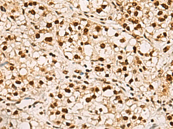 ELF5 Rabbit Polyclonal Antibody - image 1