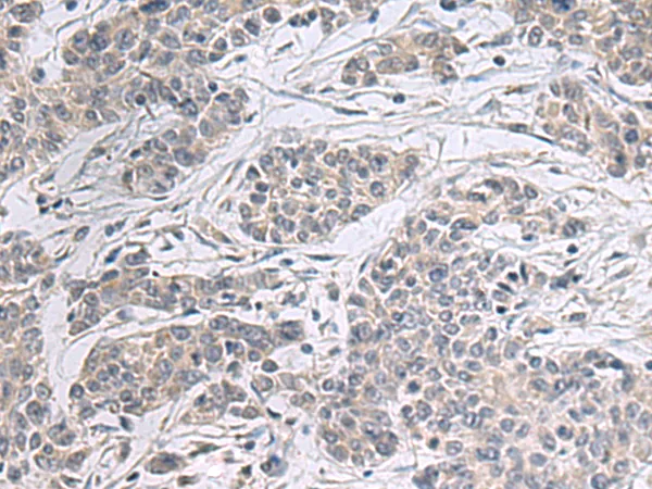 PPM1K Rabbit Polyclonal Antibody - image 1