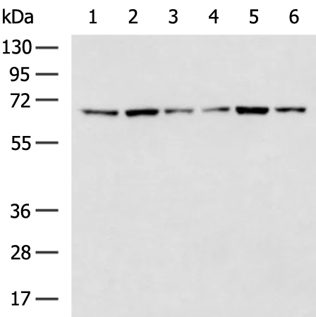 ISYNA1 Rabbit Polyclonal Antibody - image 1