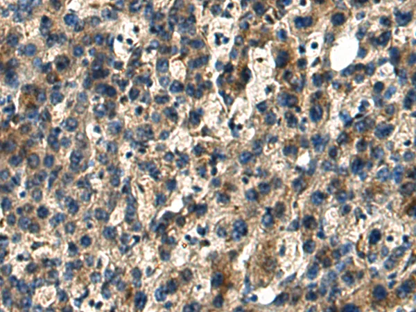 DUSP15 Rabbit Polyclonal Antibody - image 1