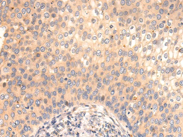 ARF5 Rabbit Polyclonal Antibody - image 1