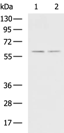 PCCB Rabbit Polyclonal Antibody - image 1
