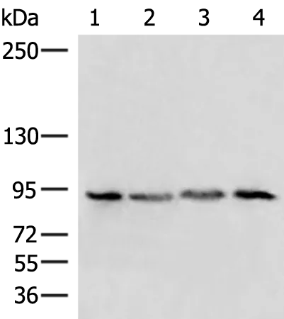 PI 3 Kinase p85 alpha (PIK3R1) Rabbit Polyclonal Antibody - image 1