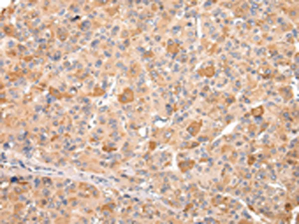 RERE Rabbit Polyclonal Antibody - image 1