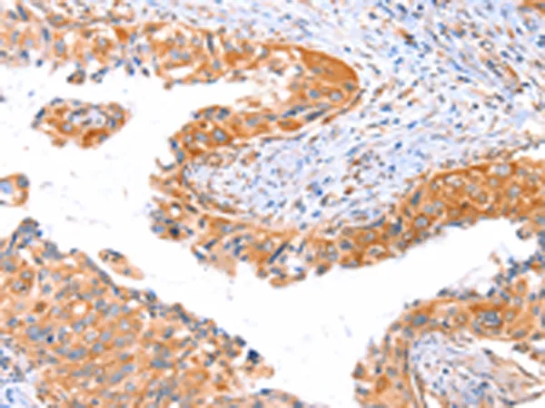 AP1B1 Rabbit Polyclonal Antibody - image 1
