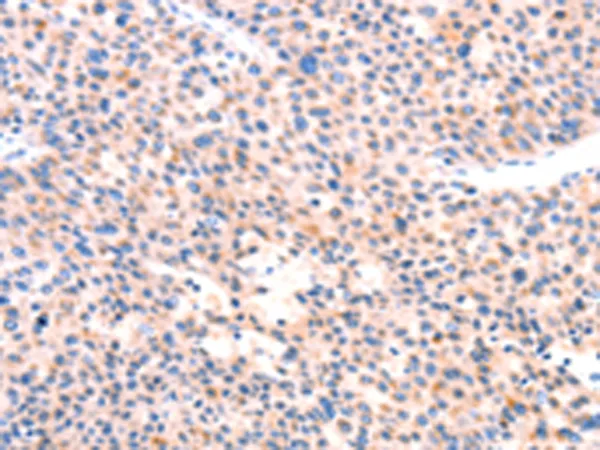 APBA2 Rabbit Polyclonal Antibody - image 1