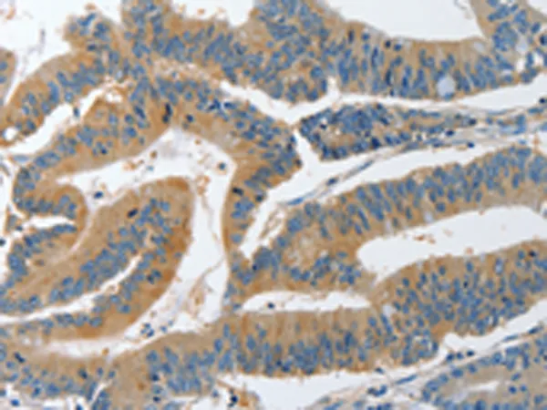PI 3 Kinase regulatory subunit 4 (PIK3R4) Rabbit Polyclonal Antibody - image 1