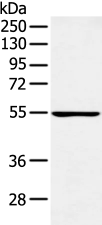 PFKFB4 Rabbit Polyclonal Antibody - image 1