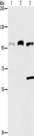 ASCC2 Rabbit Polyclonal Antibody - image 1