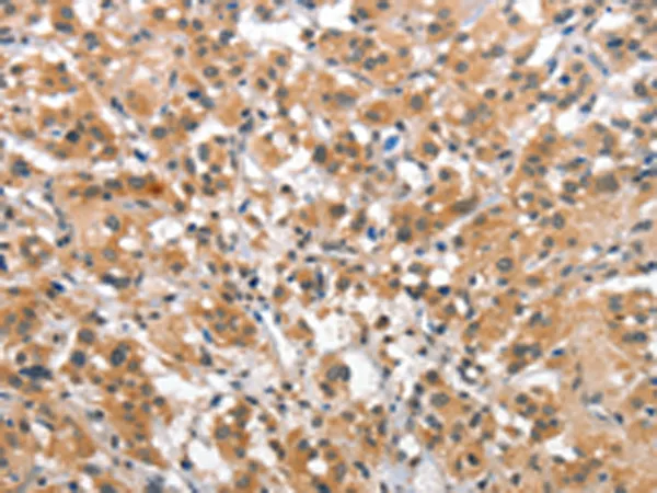 SMAD1 Rabbit Polyclonal Antibody - image 1