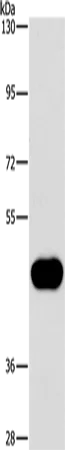 CD38 Rabbit Polyclonal Antibody - image 1