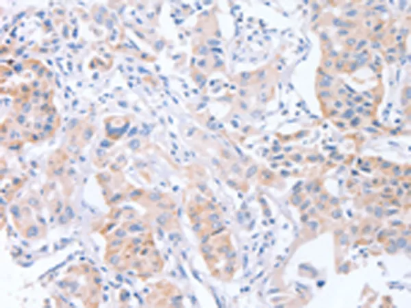 CDCA4 Rabbit Polyclonal Antibody - image 1