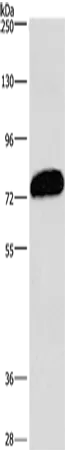 CDCP1 Rabbit Polyclonal Antibody - image 1