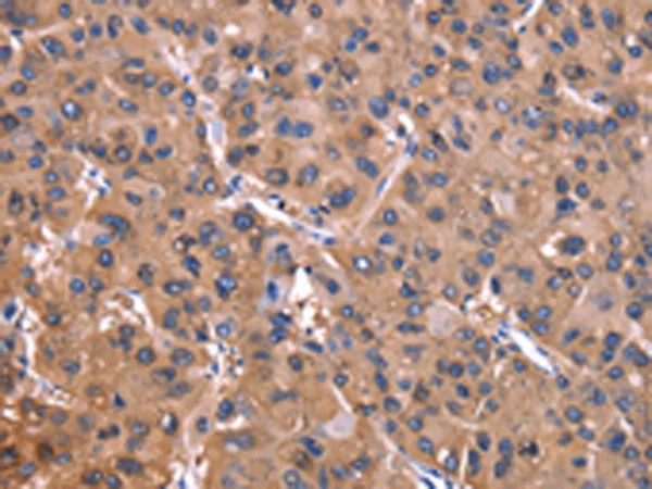 ADM2 Rabbit Polyclonal Antibody - image 1