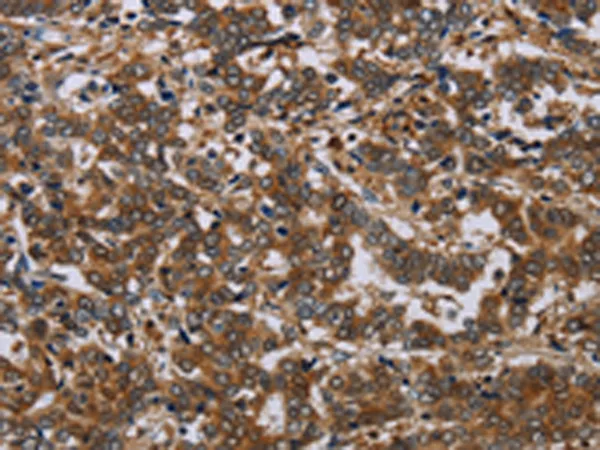 NCKAP1 Rabbit Polyclonal Antibody - image 1