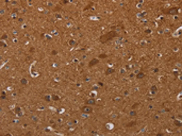 CYBB Rabbit Polyclonal Antibody - image 1