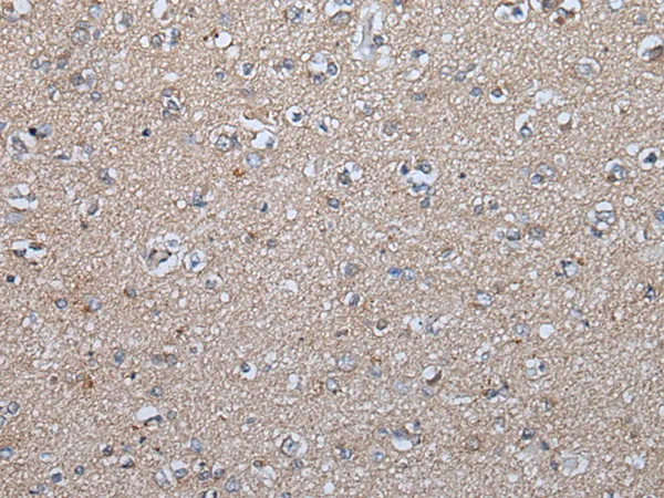 FGF5 Rabbit Polyclonal Antibody - image 1