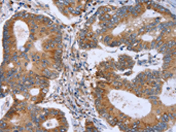 MMP9 Rabbit Polyclonal Antibody - image 1