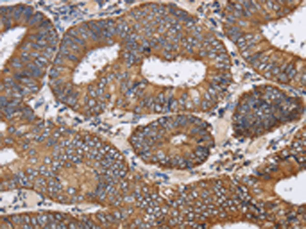 PDGFC Rabbit Polyclonal Antibody - image 1