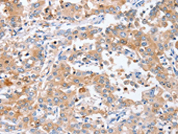 PPOX Rabbit Polyclonal Antibody - image 1
