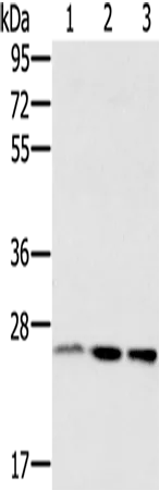 RAB8A Rabbit Polyclonal Antibody - image 1
