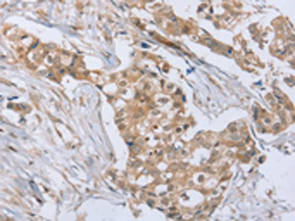 RAB8B Rabbit Polyclonal Antibody - image 1