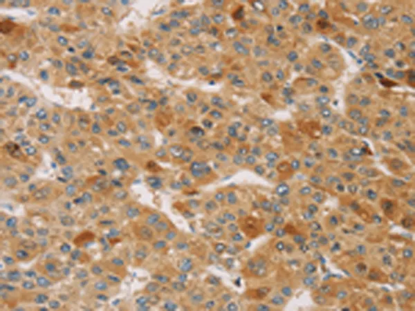 RNF35 (TRIM40) Rabbit Polyclonal Antibody - image 1