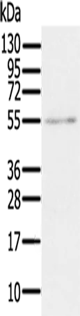 ROR beta (RORB) Rabbit Polyclonal Antibody - image 1