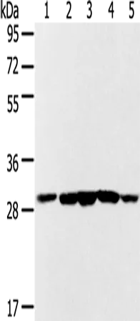 SDHB Rabbit Polyclonal Antibody - image 1